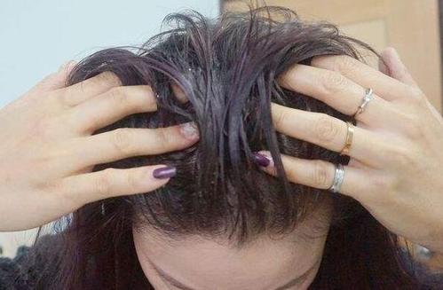 头发油腻应该怎么办？