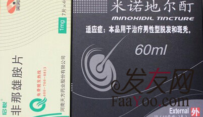 男性脱发的治疗方法都有什么呢?　
