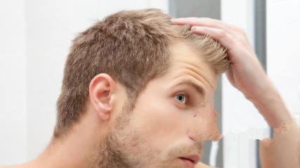 治疗男性脱发管用的方法都有哪些呢?　