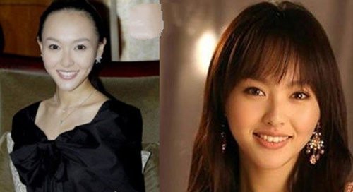 M头发应该怎么治疗，能恢复吗
