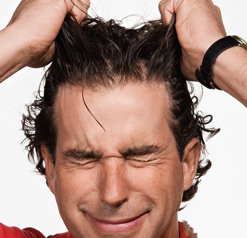 引起现代男性脱发的主要原因有哪几种？